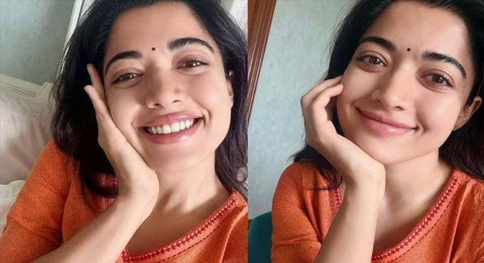 Rashmika Mandanna Opens Up About Her Leg Injury, Says Injuries Are Frustrating in Instagram Post Rashmika Mandanna Opens Up About Her Leg Injury Says Injuries Are Frustrating In Instagram Post