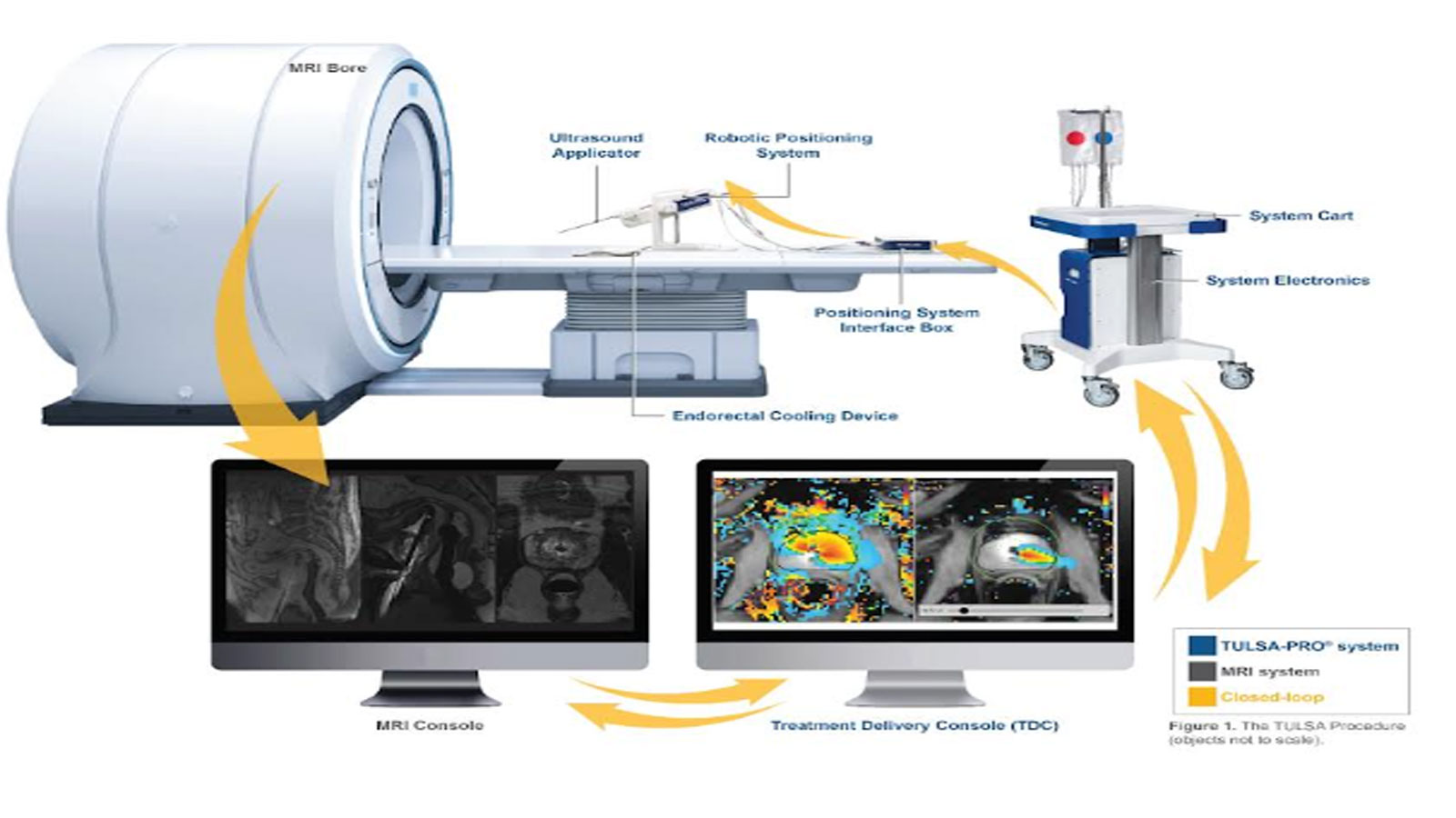 Dss Imagetech Exclusively Enables Advanced Tulsa Pro Prostate Cancer Treatment To Improve Patient Outcomes In India