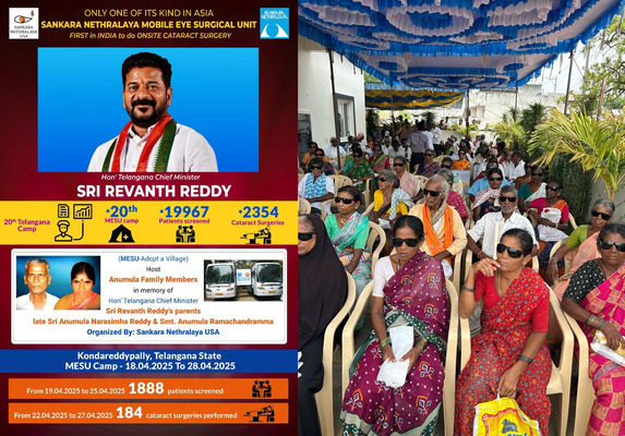 Revanth Reddy: ముఖ్యమంత్రి శ్రీ రేవంత్ రెడ్డి గ్రామములో శంకరనేత్రాలయ కంటి శిభిరం