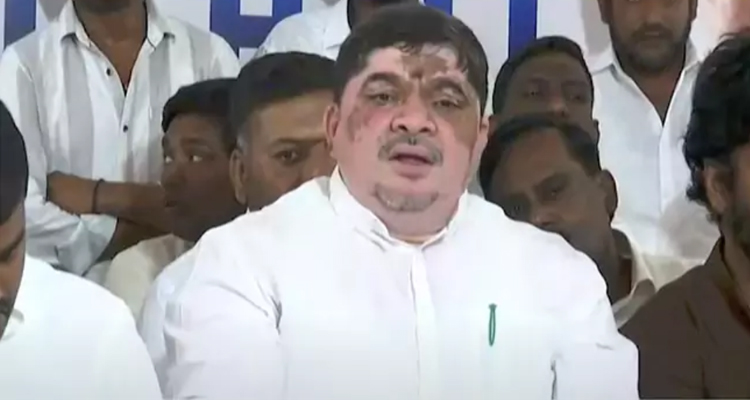 Minister Ponnam : ఇద్దరు కేంద్ర మంత్రులు ఉన్నా పట్టించుకోవడం లేదు : మంత్రి పొన్నం
