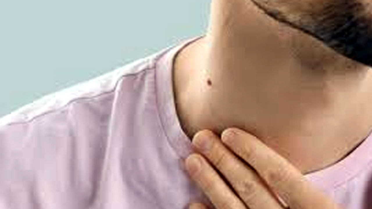 Mole Astrology What Your Body Marks Reveal About Your Luck And Personality