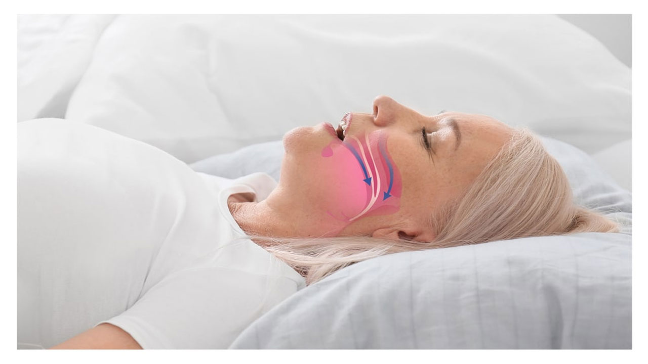 Understanding Sleep Apnea Symptoms And Risks For Better Respiratory Health And Sound Sleep