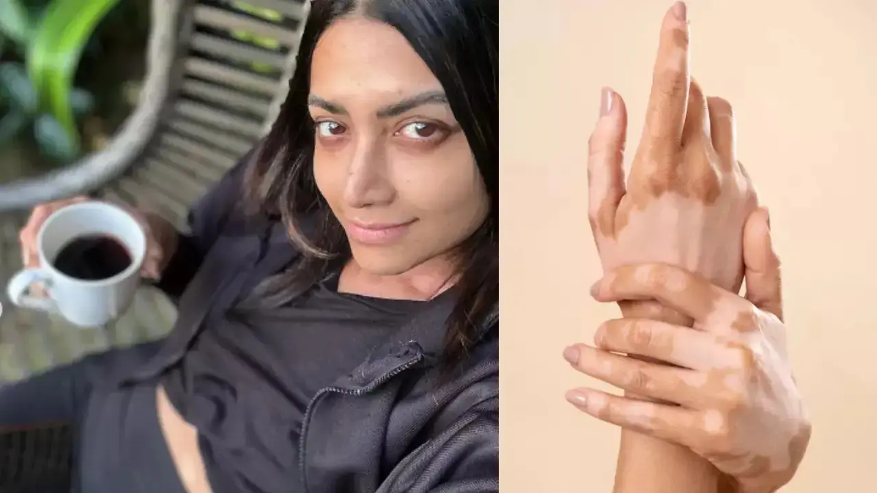 Mamta Mohandas: మమత జీవితమే పెద్ద పాఠం Mamatas Life Is A Big Lesson