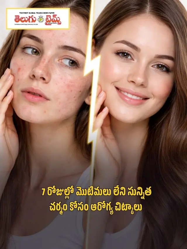 7 రోజుల్లో మొటిమలు లేని సున్నిత చర్మం కోసం ఆరోగ్య చిట్కాలు