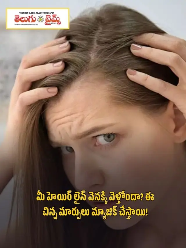 Is your hairline receding? These small changes will do the magic!