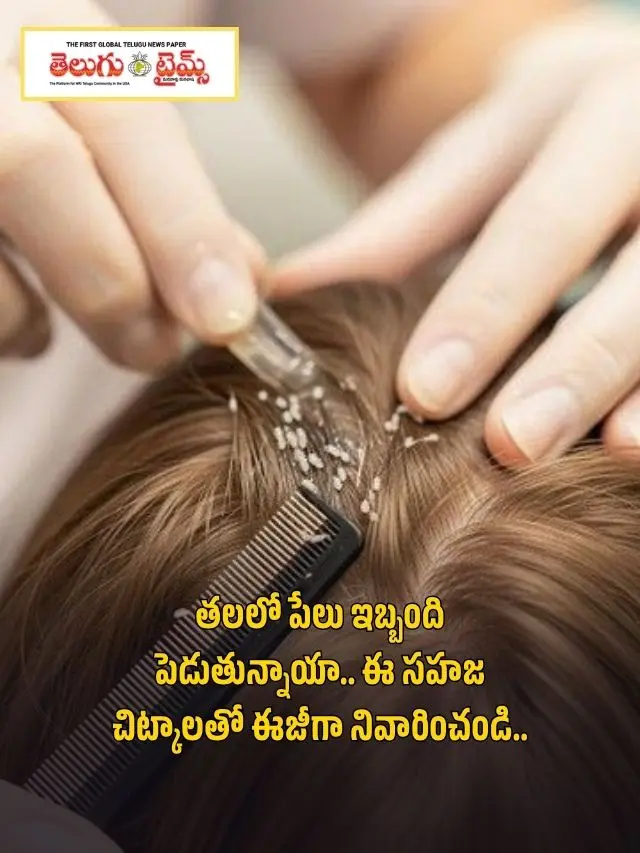 తలలో పేలు ఇబ్బంది పెడుతున్నాయా.. ఈ సహజ చిట్కాలతో ఈజీగా నివారించండి..