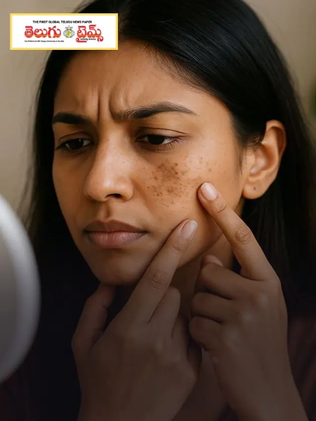 ఎన్ని సీరమ్‌లు, క్రీమ్‌లు వాడినా ముఖంపై మచ్చలు పోవడం లేదా? అయితే ఈ హోమ్ మేడ్ చిట్కాలను ప్రయత్నించండి!
