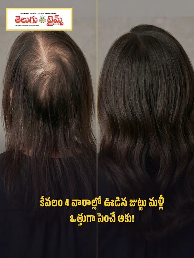 కేవలం 4 వారాల్లో ఊడిన జుట్టు మళ్లీ ఒత్తుగా పెంచే ఆకు!