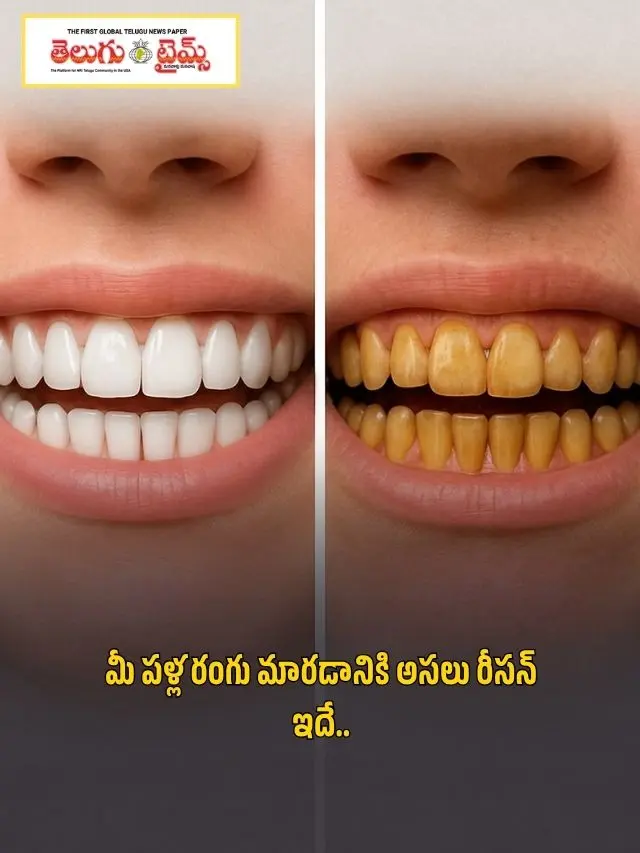 This is the real reason why your teeth are discolored