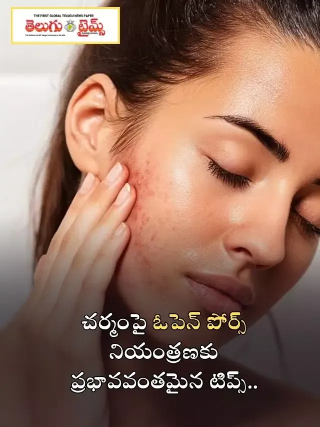 చర్మంపై ఓపెన్ పోర్స్ నియంత్రణకు ప్రభావవంతమైన టిప్స్..
