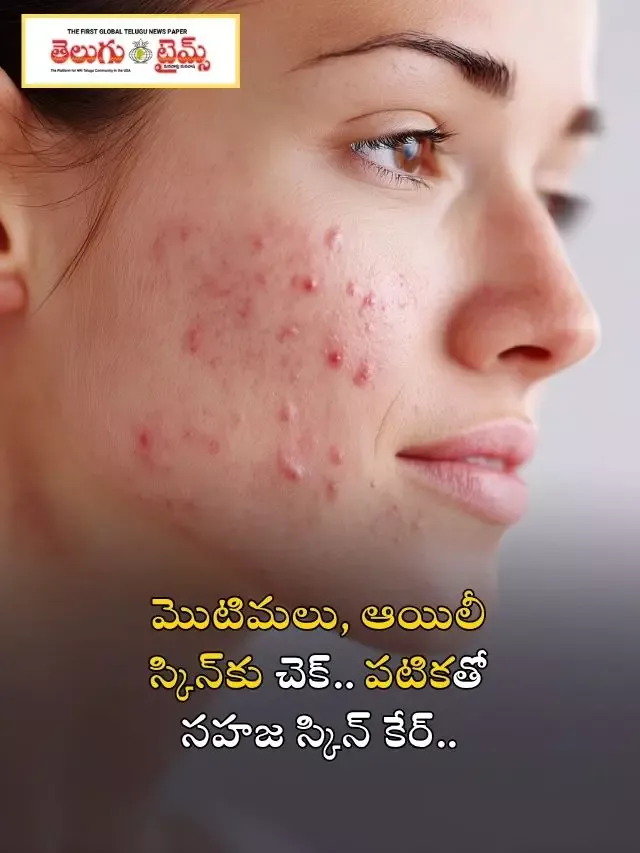 మొటిమలు, ఆయిలీ స్కిన్‌కు చెక్.. పటికతో సహజ స్కిన్ కేర్..