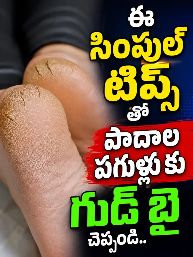 ఈ సింపుల్ టిప్స్ తో పాదాల పగుళ్లు కు గుడ్ బై చెప్పండి..