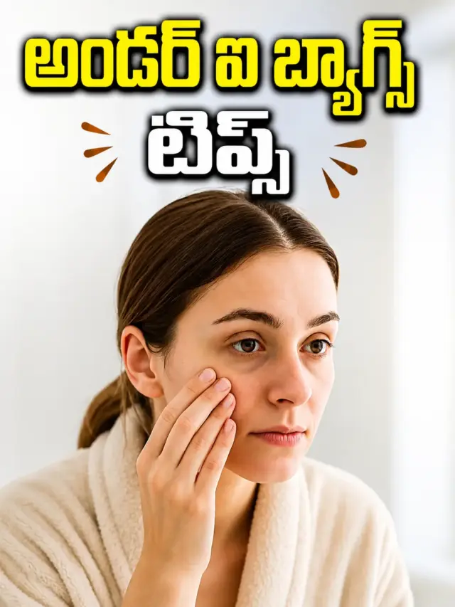 అండర్‌-ఐ బ్యాగ్స్‌తో ఇబ్బంది పడుతున్నారా..? ఇవి తెలుసుకోండి!