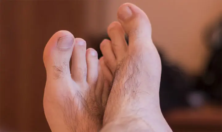 What Hair On Your Toes Reveals About Your Heart Health And Blood Circulation