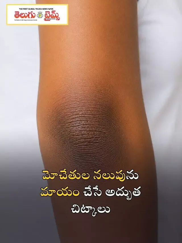 మోచేతుల నలుపును మాయం చేసే అద్భుత చిట్కాలు