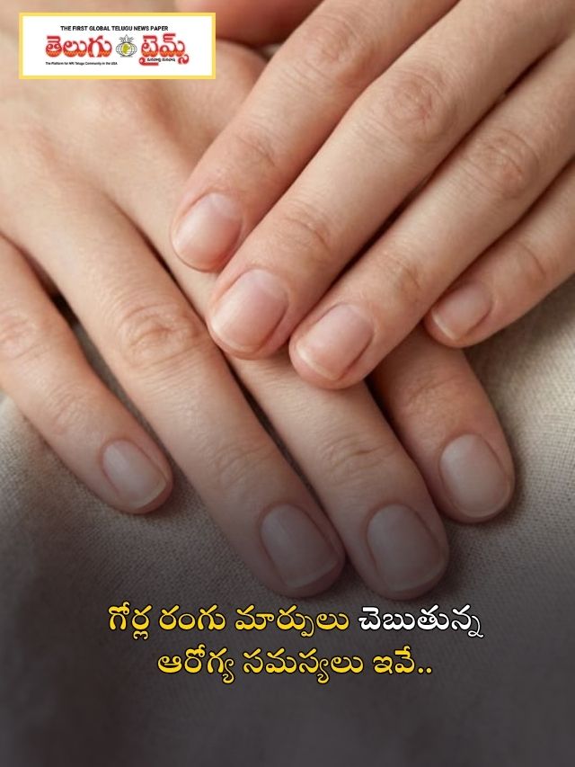 గోర్ల రంగు మార్పులు చెబుతున్న ఆరోగ్య సమస్యలు ఇవే..