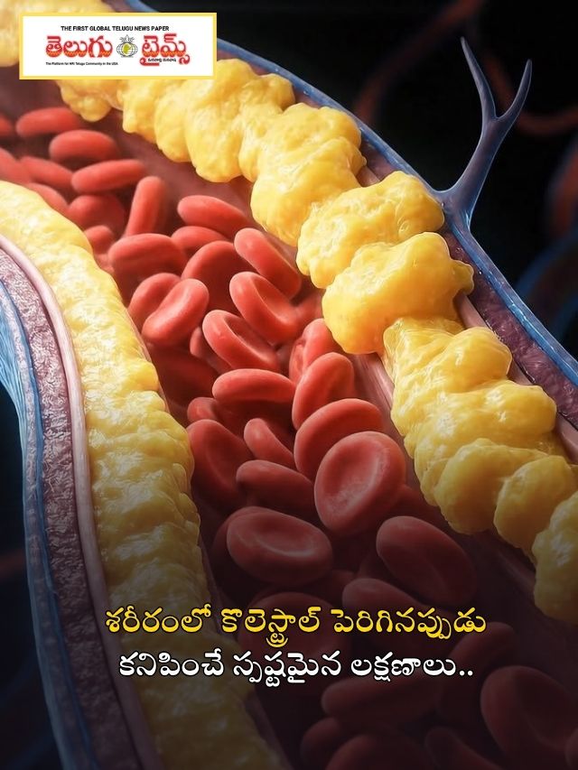 రక్తనాళాల్లో కొవ్వు పెరిగిందని చెప్పే మొదటి లక్షణాలు ఇవే!