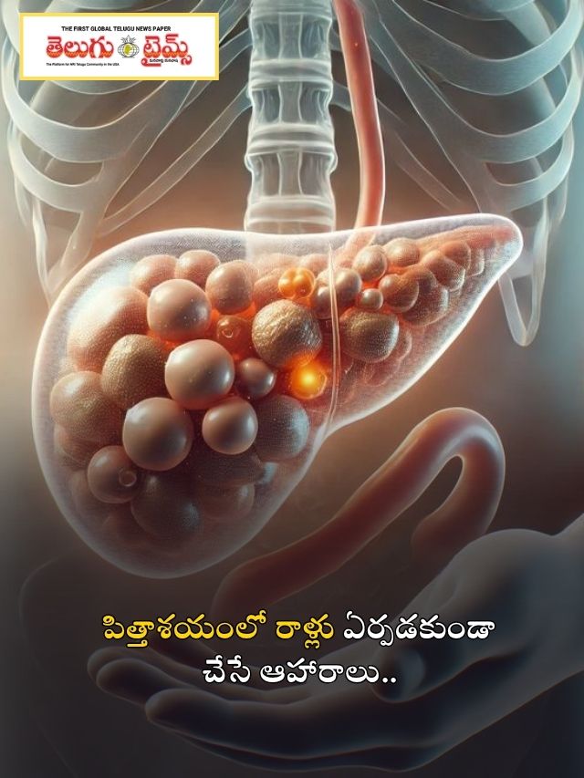 పిత్తాశయంలో రాళ్లు ఏర్పడకుండా చేసే ఆహారాలు..
