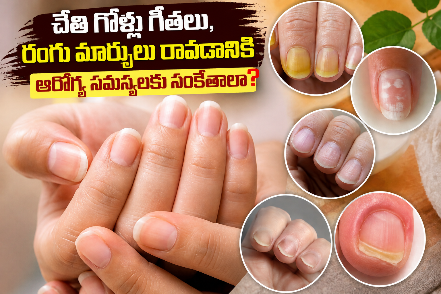 చేతి గోళ్లపై గీతలు పడటం, రంగు మారడం ఆరోగ్య సమస్యలకు సంకేతమా? Are Ridges And Color Changes In Fingernails Signs Of Health Problems