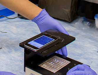 ఇన్ఫెక్షన్లను పసిగట్టే స్మార్ట్ ఫోన్ రీడర్