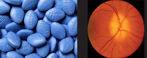 వయాగ్రాతో కళ్లకు తీవ్ర నష్టం!