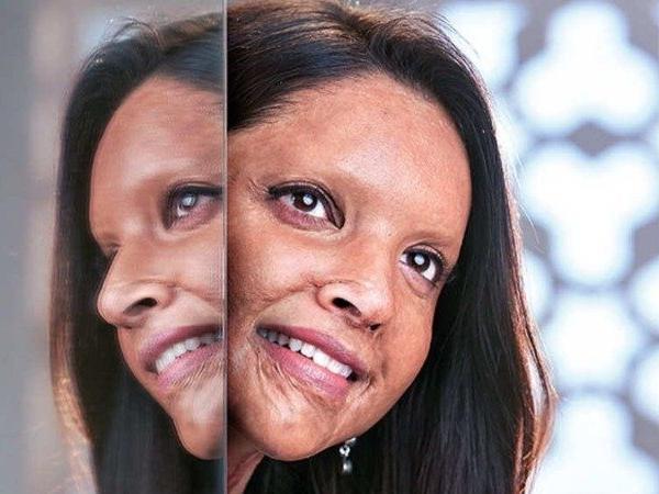 ఛపాక్ లో దీపిక ఫస్ట్ లుక్ విడుదల