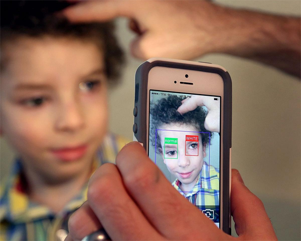 కంటి కేన్సర్‌ను గుర్తించే యాప్‌