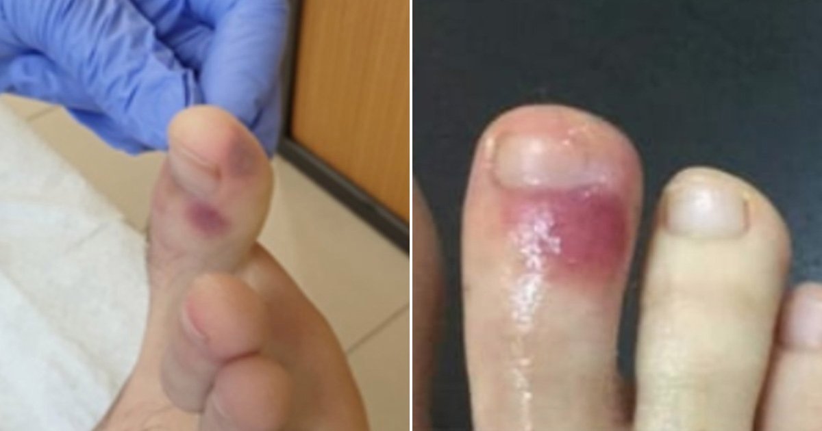 ఇలాంటి లక్షణాలు కరోనాకు సంకేతాలు!