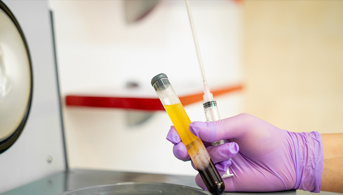 ప్లాస్మా ఇంజెక్షన్ తో వైరస్ కు అడ్డుకట్ట ప్లాస్మా ఇంజెక్షన్ తో వైరస్ కు అడ్డుకట్ట