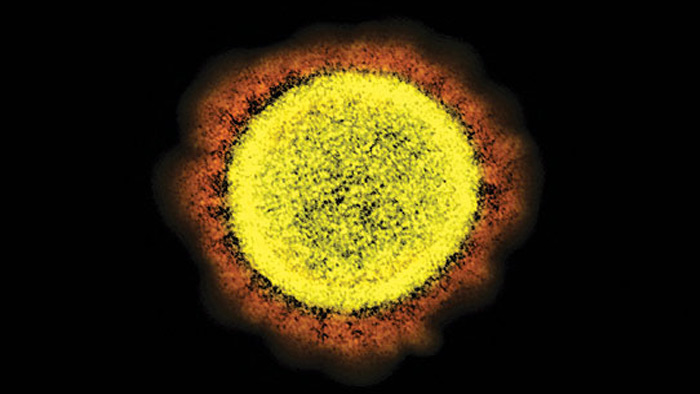 ఇదే కరోనా అసలు రూపమన్న అమెరికా పరిశోధకులు
