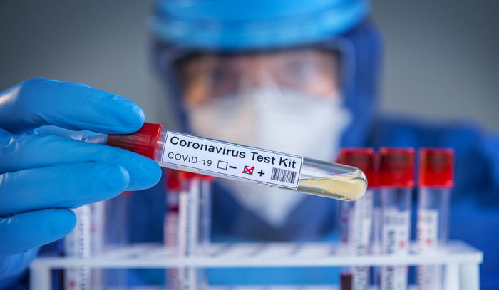 జోరు తగ్గని కరోనా కేసులు