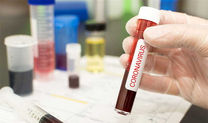 ఏపీలో  5,210 మందికి పాజిటివ్