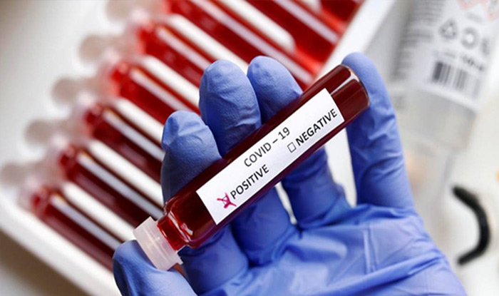 తెలంగాణలో కొత్తగా 1,717 కేసులు