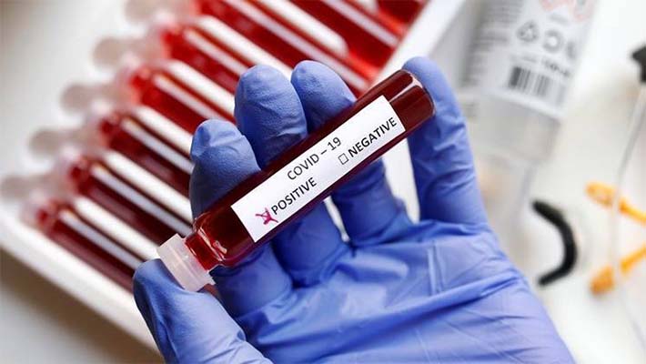 ఏపీలో విజృంభిస్తున్న కరోనా… భారీగా పెరిగిన కేసులు