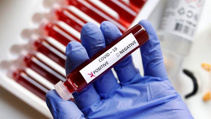 ఏపీలో కొత్తగా 1,288 కేసులు