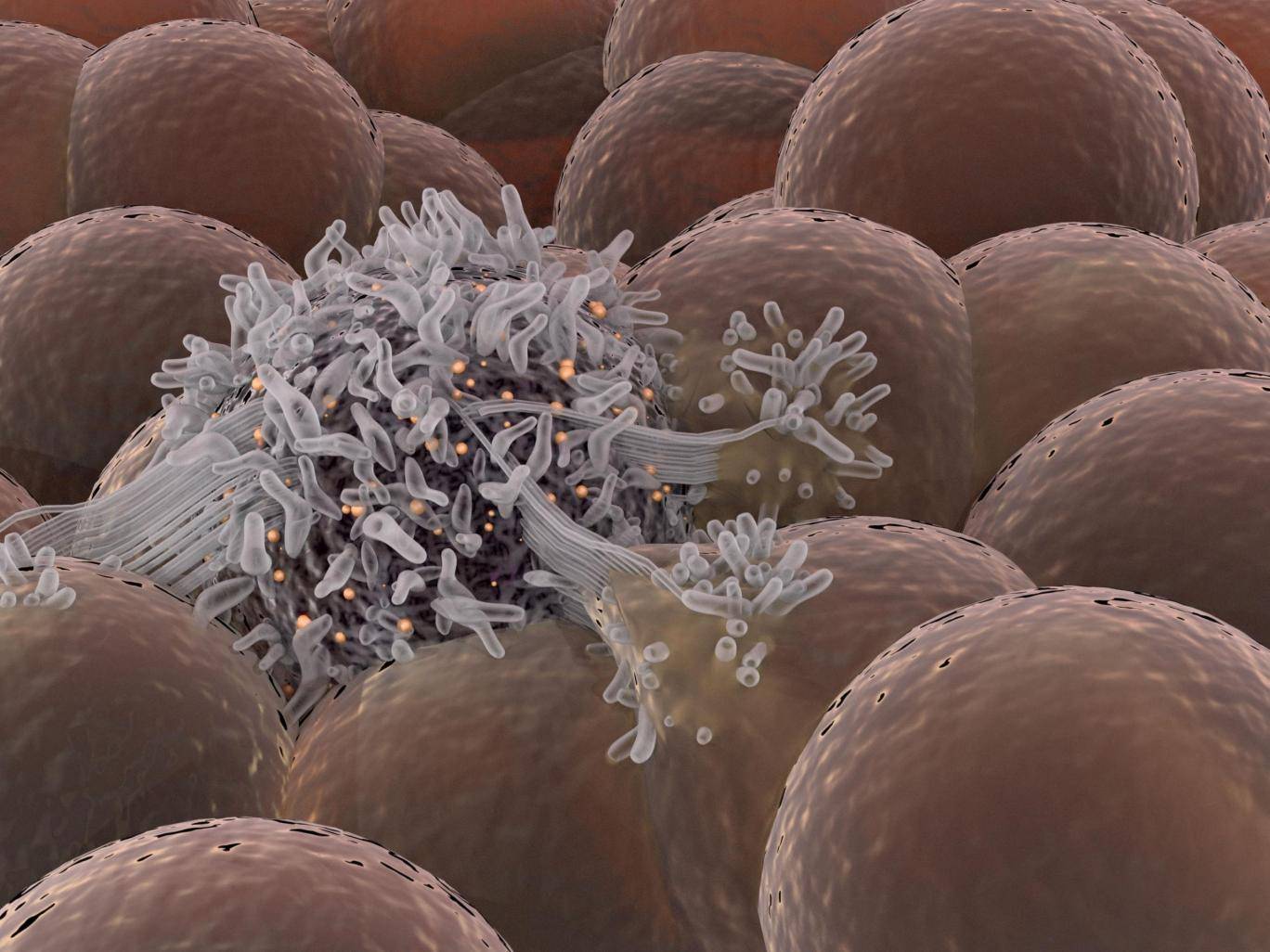 కేన్సర్‌ను కనిపెట్టే సూక్ష్మ అణువులు