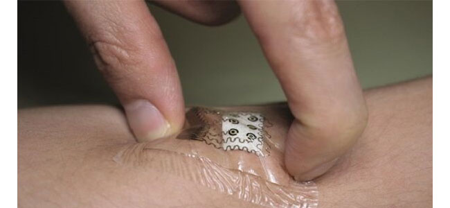 షుగర్‌ పేషెంట్లకు శుభవార్త