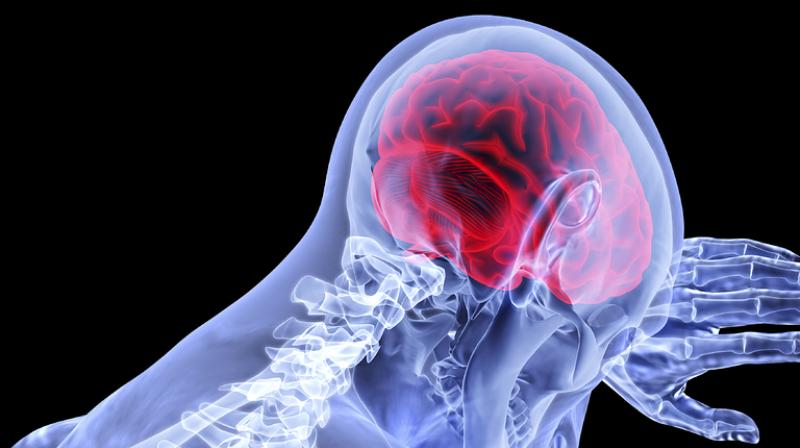 కణ చికిత్సతో అల్జీమర్స్ కు చెక్