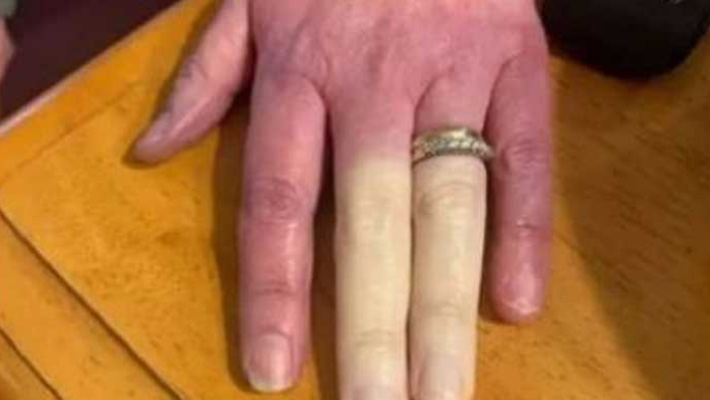 అమెరికాలో ఓ మహిళకు విచిత్రమైన సమస్య!