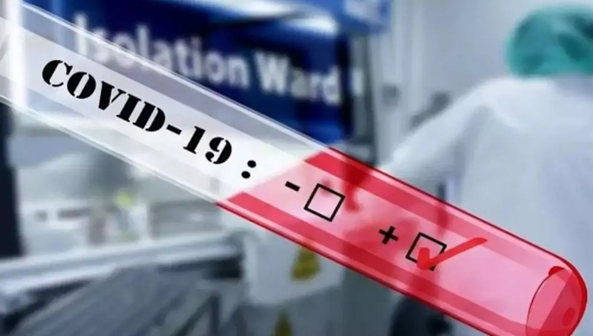 ఏపీలో కొత్తగా 6,341 కరోనా కేసులు