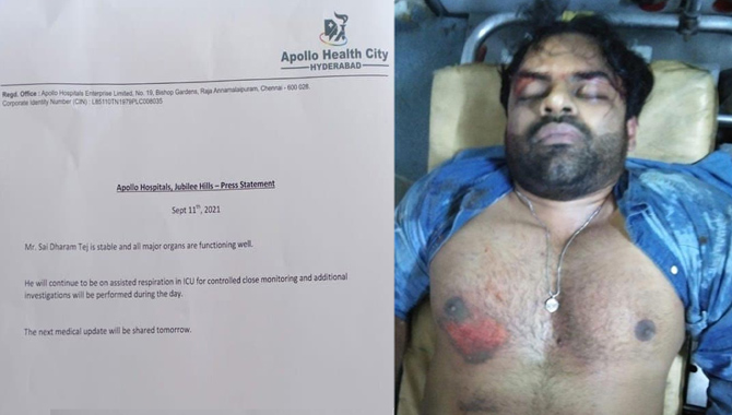 సాయిధ‌రమ్ తేజ్ హెల్త్ కండిష‌న్ అప్‌డేట్‌.. సాయి తేజ్ ఆరోగ్యం నిలకడగా ఉందని చెప్పిన డాక్టర్స్