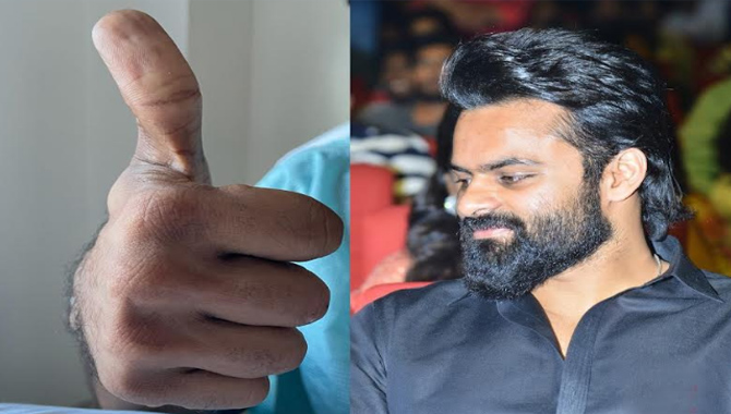 పుకార్లలకు చెక్ పెడుతూ .. థంబ్ సిగ్నల్ తో ట్వీట్ పెట్టి హెల్త్ అప్డేట్ ఇచ్చిన సాయి ధరమ్ తేజ్