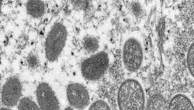 20 దేశాల్లో మంకీపాక్స్