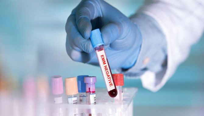 ప్రపంచ వ్యాప్తంగా పది మందికే..