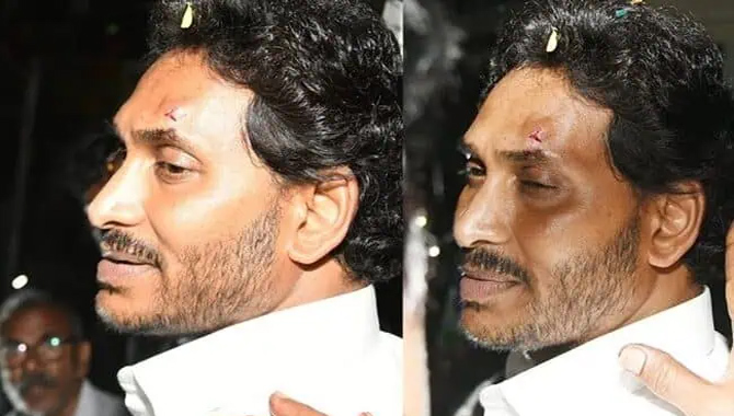 సీఎం జగన్ పై జరిగింది హత్యాయత్నమా…?